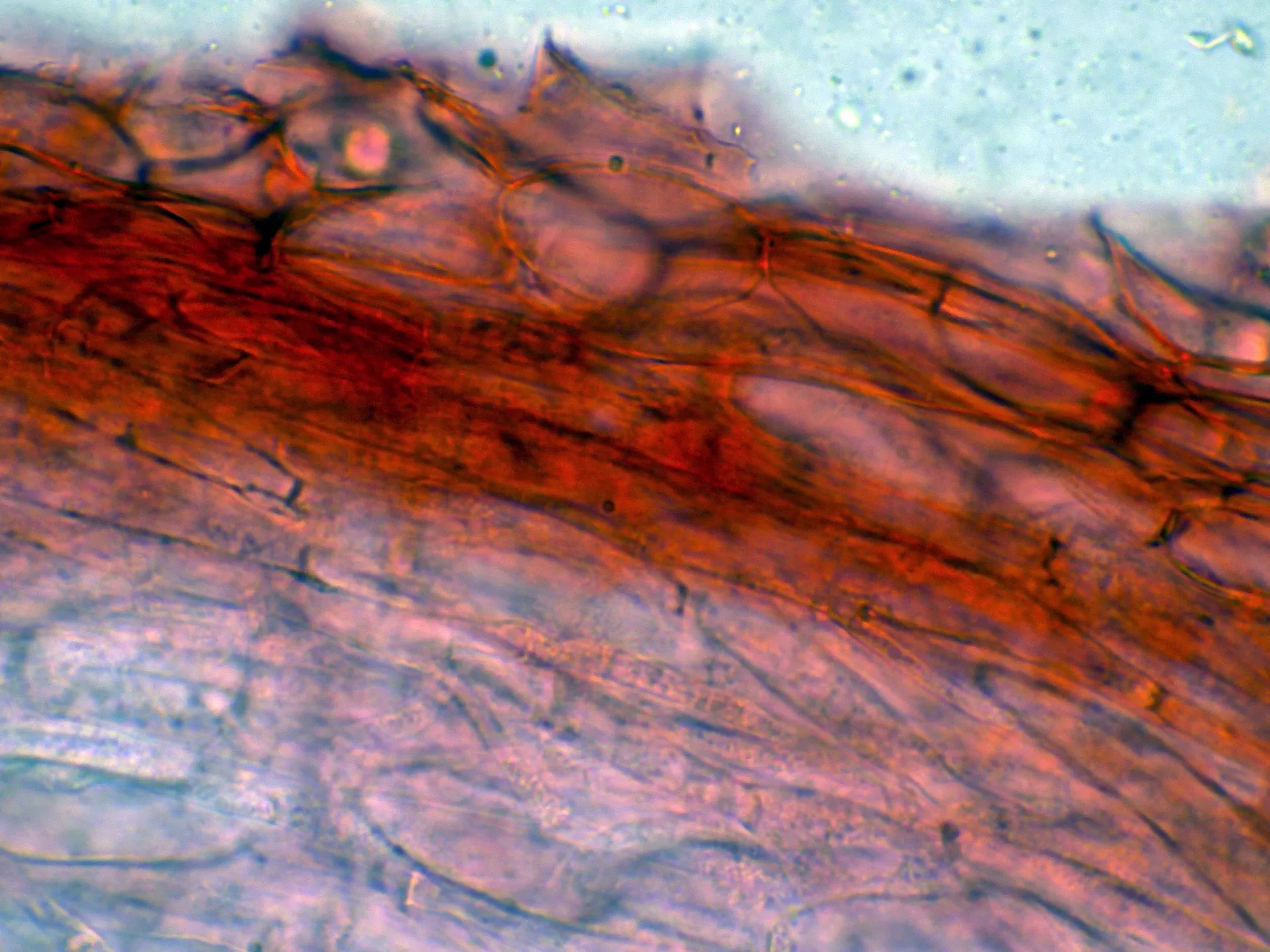 Microscopía de Mycena citrinovirens - 10 - Subpellis -001